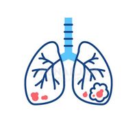 Lungcancer